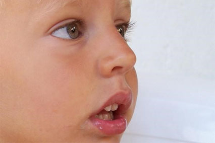Аденоидный тип лица формируется при длительном дыхании открытым ртом.