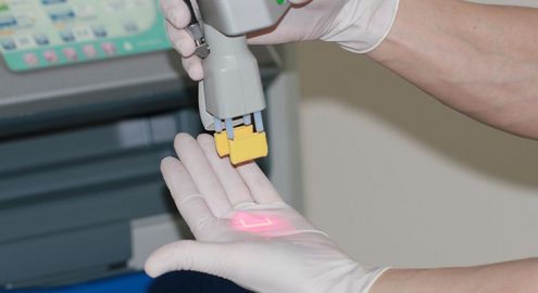 Лечение лазером: все направления лазерной медицины