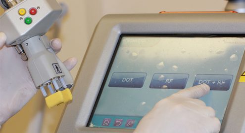 Многофункциональная лазерная система SmartXide DOT2® в Нордине