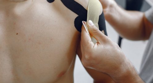Кинезиотейпирование: что это за методика и как она помогает организму