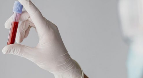 Кто такой гематолог? Разбираемся, когда стоит обратиться к данному специалисту