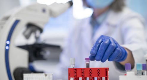 Золотой стандарт выявления аутоиммунных заболеваний! Определяем антинуклеарный фактор