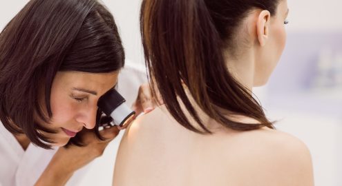 Контагиозный моллюск: симптомы и лечение