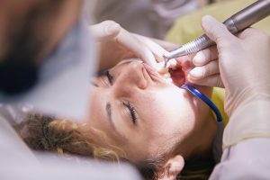 Лечение периодонтита у стоматолога