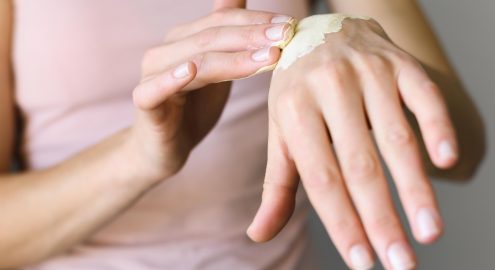 Себорейный дерматит. О симптомах заболевания и его лечении говорим с дерматовенерологом Витавой БРЕЛЬ